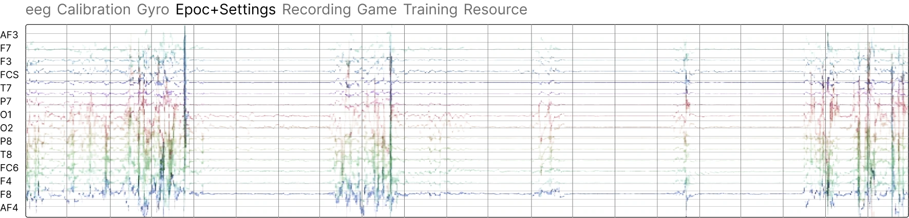 EEG recording view. Signal traces and model predictions are distinct outputs.